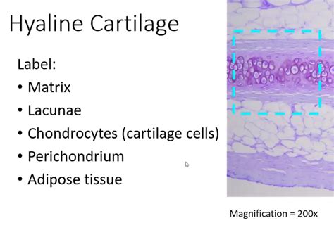 Solved Hyaline Cartilage Label Matrix Lacunae Chondrocytes Cartilage