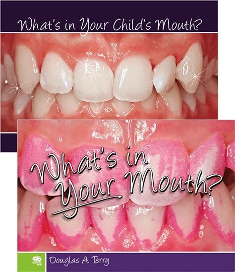 Whats In Your Mouth Whats In Your Childs Mouth Docmode Health
