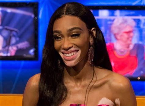 Winnie Harlow Neden Sosyal Medyada Eleştiri Yağmuruna Tutuldu