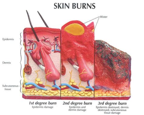 How many colors are there in the human rainbow? Skin Model Labeled - Bing Images | Burns nursing, Integumentary system, Daily health tips