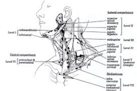 Pin By Allyson Chong On Health Mld Lymphedema Treatment Lymph Nodes