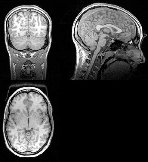 Example Of Static Mri Anatomical Image Clockwise From Top Left