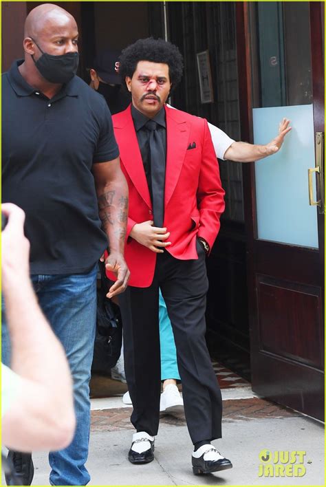 Bts make explosive vmas debut with 'dynamite' at 2020 mtv vmas. Full Sized Photo of the weeknd bruised face for vmas 03 ...