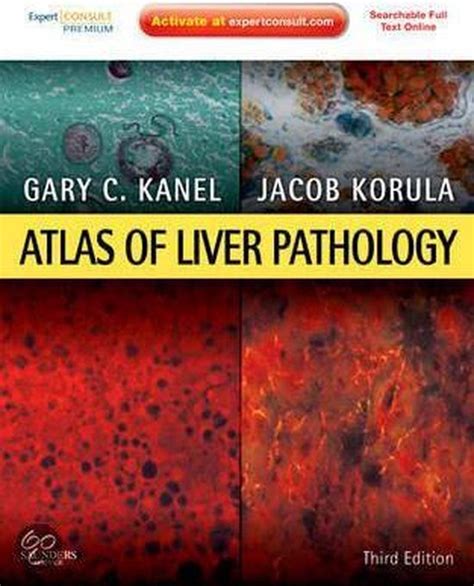Atlas Of Liver Pathology Ebook Md Kanel Gary C 2370003826258