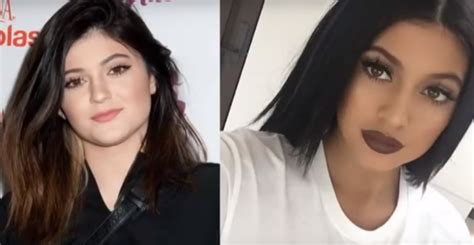 Kylie Jenner Plastic Surgery Transformations Top Piercings