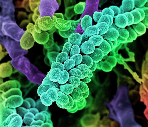 Streptococcus Bacteria By Science Photo Library Ph
