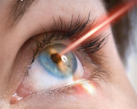 Is There Any Limit Power Range For Lasik Surgery For Eye