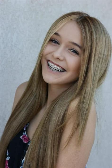Pin By Smiles By Glenos And Hadgis Orth On Braces On Celebrities Long Hair Styles Cute Girls