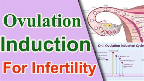 Ovulation Induction For Infertility Natural Method Iui Ivf Procedure