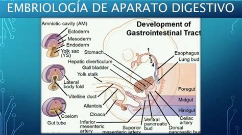 Diverticulo De Meckel