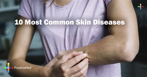 Most Common Skin Disorders