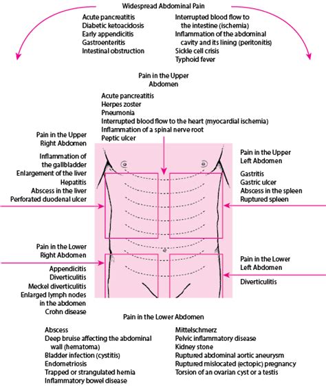 Figure Causes Of Abdominal Pain By Location Msd Manual Consumer Version