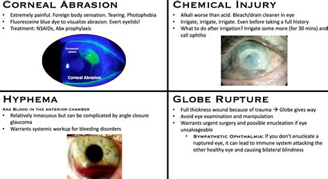 Eye Trauma — Ophthobasics