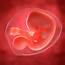 Embryo At 5 Weeks Photograph By Sciepro/science Photo Library