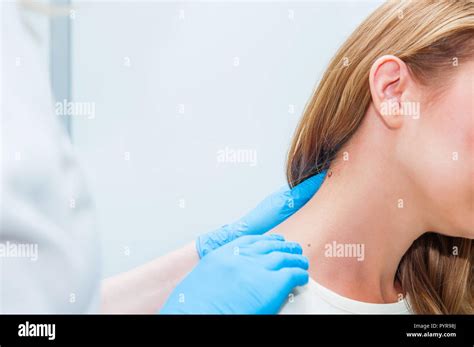 Doctor Dermatologist Examines Birthmark Of Patient Close Up Checking