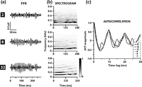 Figure 21 From Chapter 2 Signal Processing Model Of Human Auditory