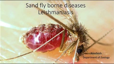 Sand Fly Born Disease Leishmaniasis Youtube