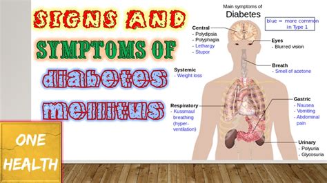 Signs And Symptoms Of Diabetes Mellitus One Health Youtube