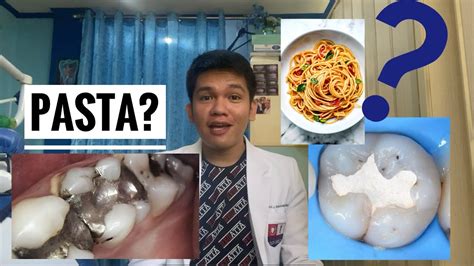 Tooth Filling Pasta Amalgam Or Composite Youtube