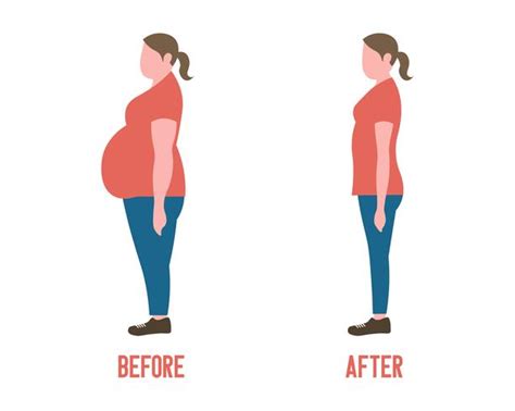 Body Shape Women Before And After Weight Loss 661998 Vector Art At Vecteezy