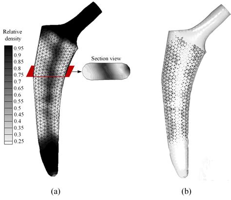 Hip Implant Design With Three Dimensional Porous Architecture Of