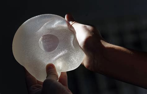 Breast Implants Cancer 9 Women Died After Implants Fda Says Fortune