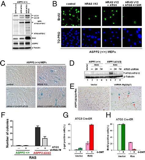High Levels Of Autophagy Bypass Oncogenic Ras Induced Senescence