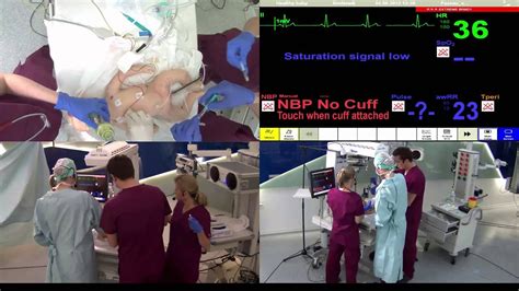 Simulation Training A Neonatology Resuscitation Scenario Youtube