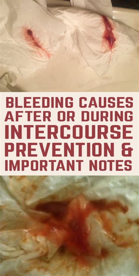 Bleeding Causes After Or During Intercourse Prevention And Important Notes