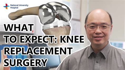 Nuh Knee Replacement Surgery What To Expect Youtube