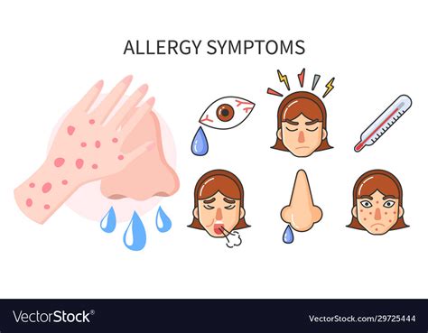 Allergy Symptoms Infographics Collection Vector Image