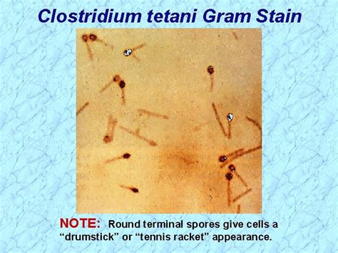Clostridium Spores Clostridium Form Endospores Under Adverse Environmental