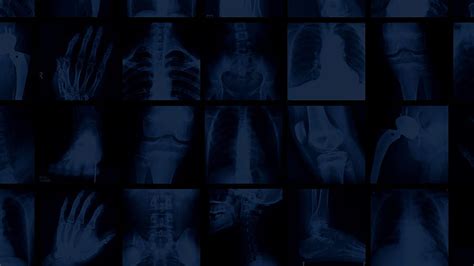 The Better To See You With Radiologic Technologist Hd Wallpaper Pxfuel