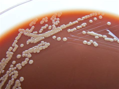 All Sizes Neisseria Subflava Growing On Columbia Chocolate Blood Agar