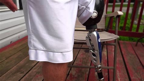 Amputeeot How An Above Knee Ak Prosthetic Leg Works Doovi