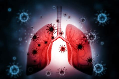 Algorithm Reduces Antibiotic Use In Lower Respiratory Tract Infection