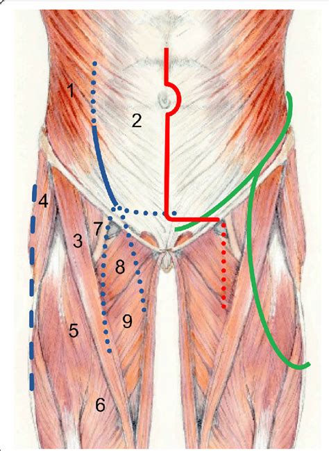 Schematic Drawing Of The Muscular Anatomy Of The Anterior Abdominal