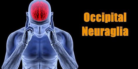 Multiple Sclerosis Ms Symptoms Occipital Neuralgia Occipital