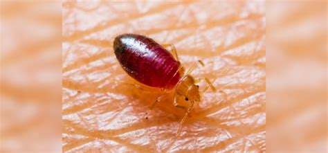 Can Bed Bugs Go In Your Ear Dont Miss 2023 Updated