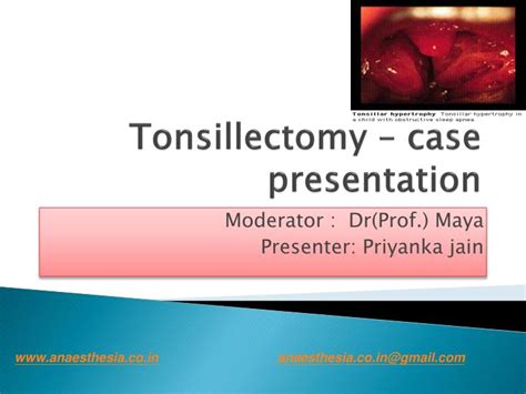 Ppt Tonsillectomy Case Presentation Powerpoint Presentation Free