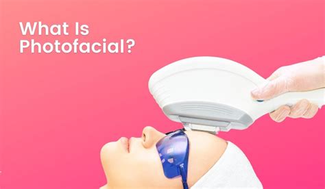 What Is Photofacial Types Benefits And Side Effects Lumenessa