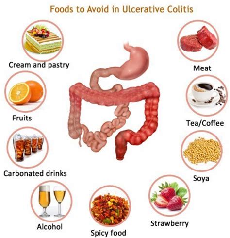 Diet For Colitis