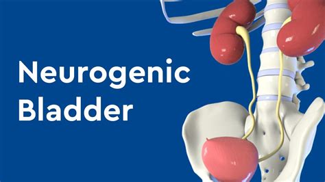 Neurogenic Bladder Symptoms Causes Tests And Treatment
