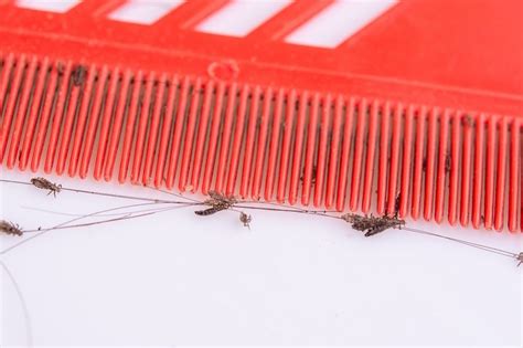 Hidden Costs Of At Home Lice Lice Treatments Fresh Heads Lice Removal