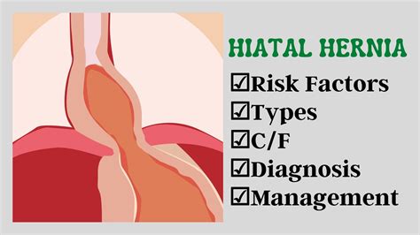 Hiatal Hernia Risk Factors C F Diagnosis Management Urdu Youtube