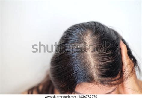 Women Thin Hair There Pulses Hair Stock Photo 1636789270 Shutterstock
