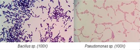 Gram Staining Of Bacillus And Pseudomonas Species