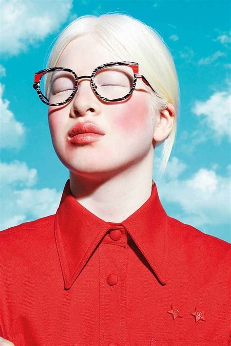 Abandoned As A Baby Due To Albinism Xueli Grew Up To Become A Vogue