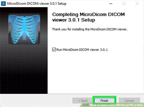 3 Ways To Open A Dicom File On Pc Or Mac Wikihow Tech
