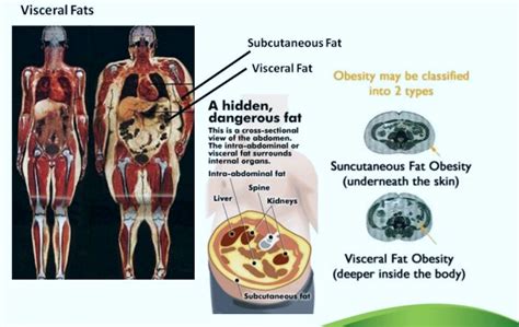 Types Of Body Fat And The Dangers Of Visceral Fat Dexafit